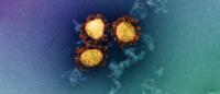 A transmission electron micrograph of negative-stained SARS-CoV-2 Omicron variant virions, false-coloured
